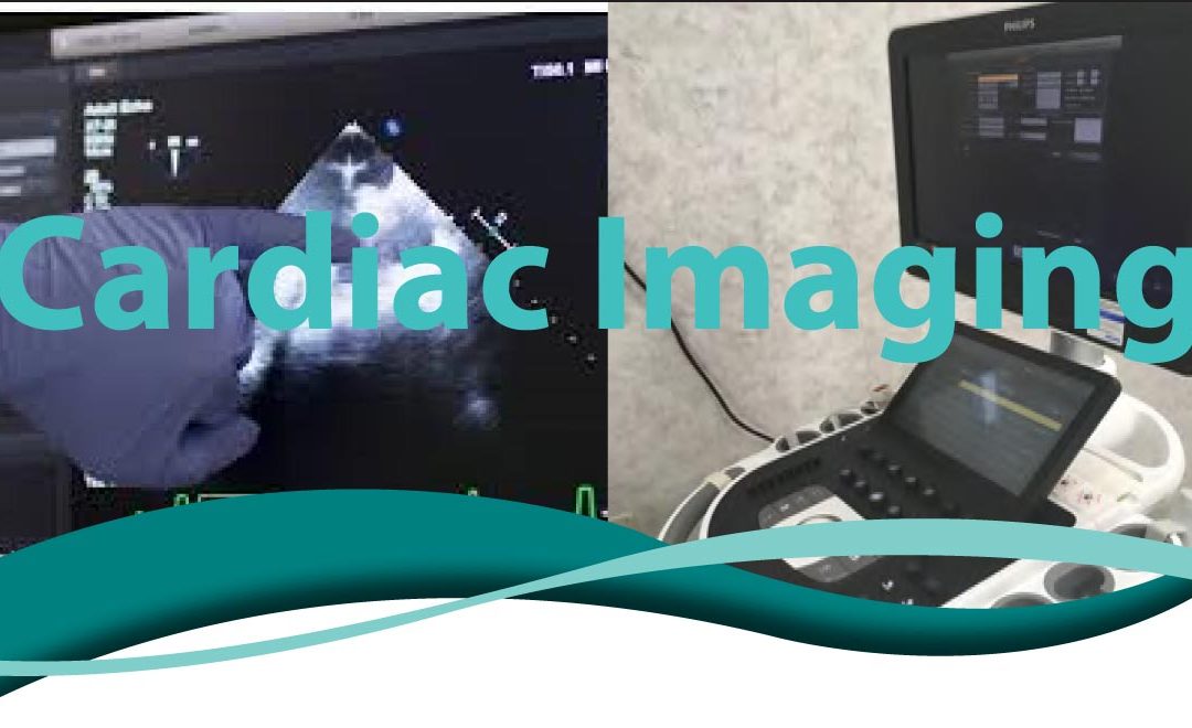 Cardiac Imaging FAQ